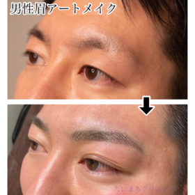 眉毛 医療アートメイクができるおすすめクリニック一覧 技術 評判が良い順